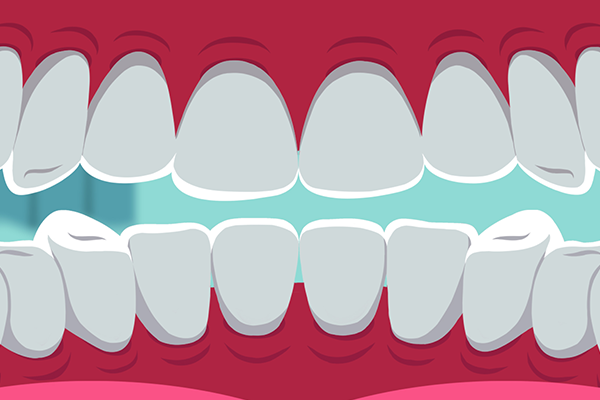 智齿牙龈肿痛不能吃什么 智齿导致牙龈肿痛怎么办