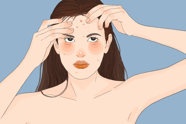 皮肤免疫力下降怎么办 皮肤免疫力下降怎么办啊